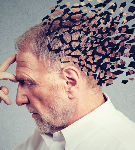 Dementia treatment in narasaraopet